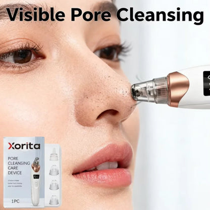 Blackhead Remover Pore