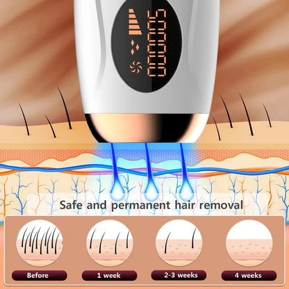 Professional IPL Laser Hair Remover